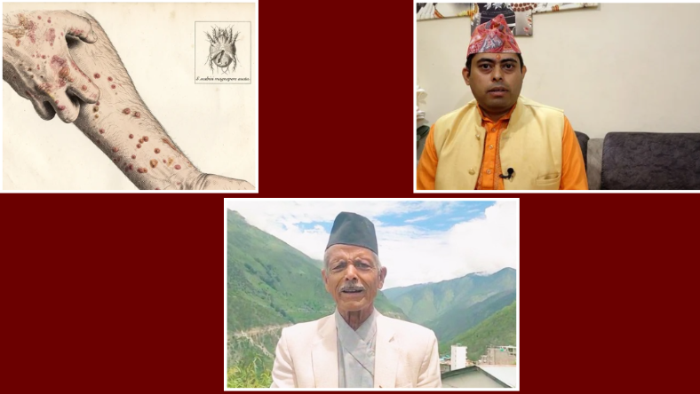 ‘लुतो जा...’, रोग भागोस्’ भन्दै यसरी मनाइन्छ सुदूरपश्चिममा लुतो पर्व